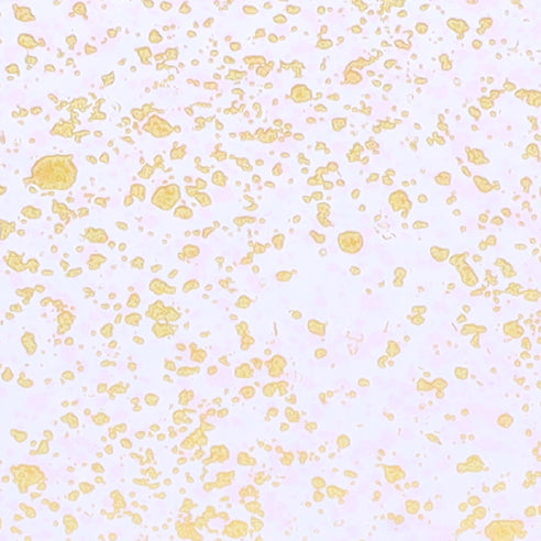 CD4 Transparent Gold Dots